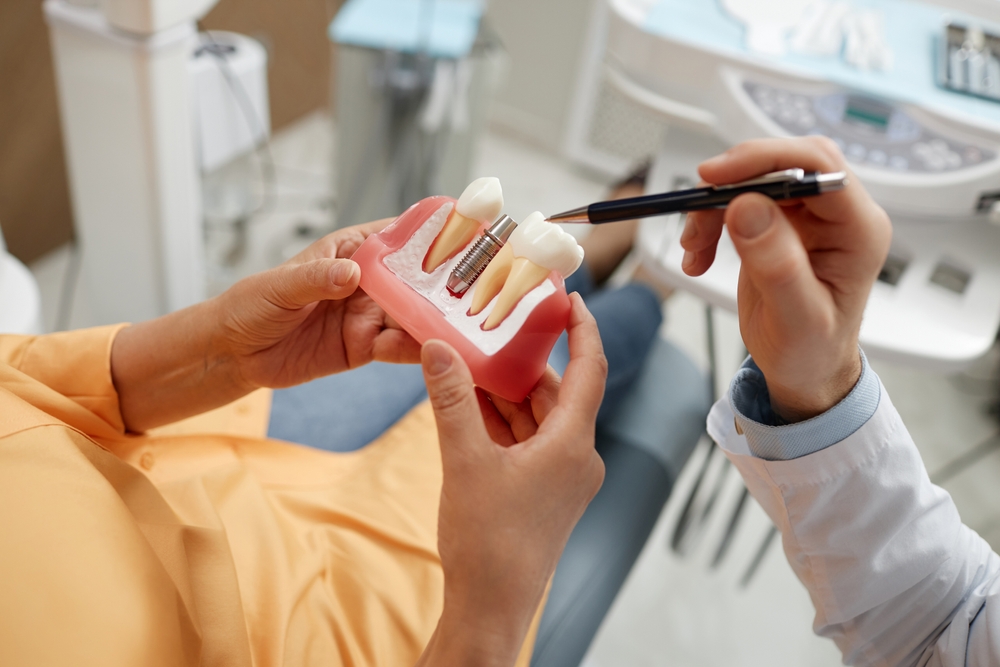 A dentist explains a dental implant procedure to a patient using a model of teeth and jawbone, showcasing restorative treatment options – Dentist in South Hill WA