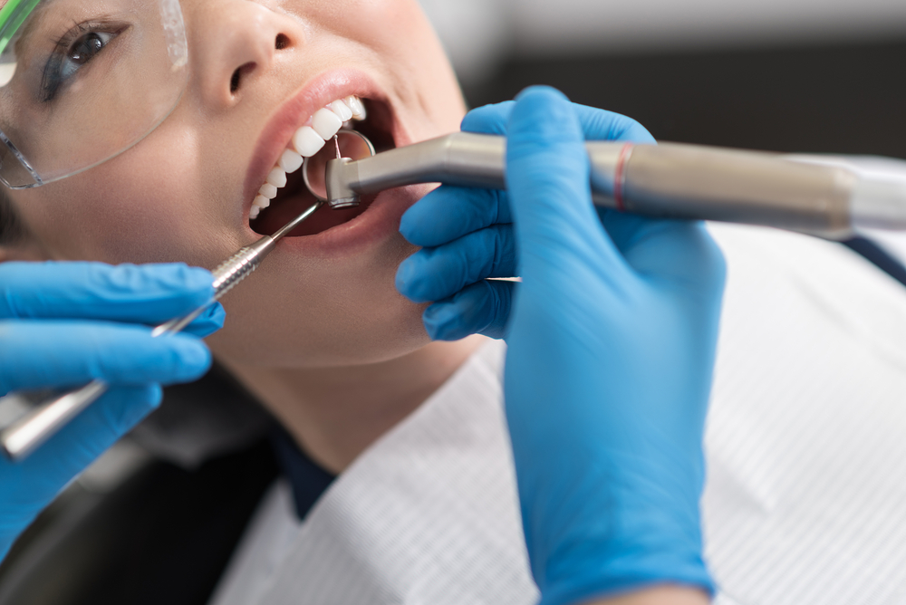 Close-Up of Dental Cleaning Procedure with Patient in Chair – Dentist Orting WA A patient receives a professional dental cleaning as a gloved hygienist uses a dental scaler and polishing tool, highlighting oral health care – Dentist Orting WA
