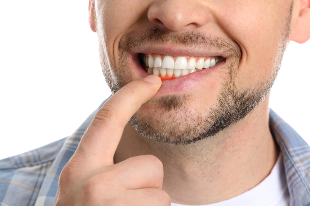 Man Pointing to Gums After Dental Exam – Cleaning and Exams Close-up of a smiling man pointing to his gums, showing clean and healthy teeth after a dental examination – Cleaning and Exams