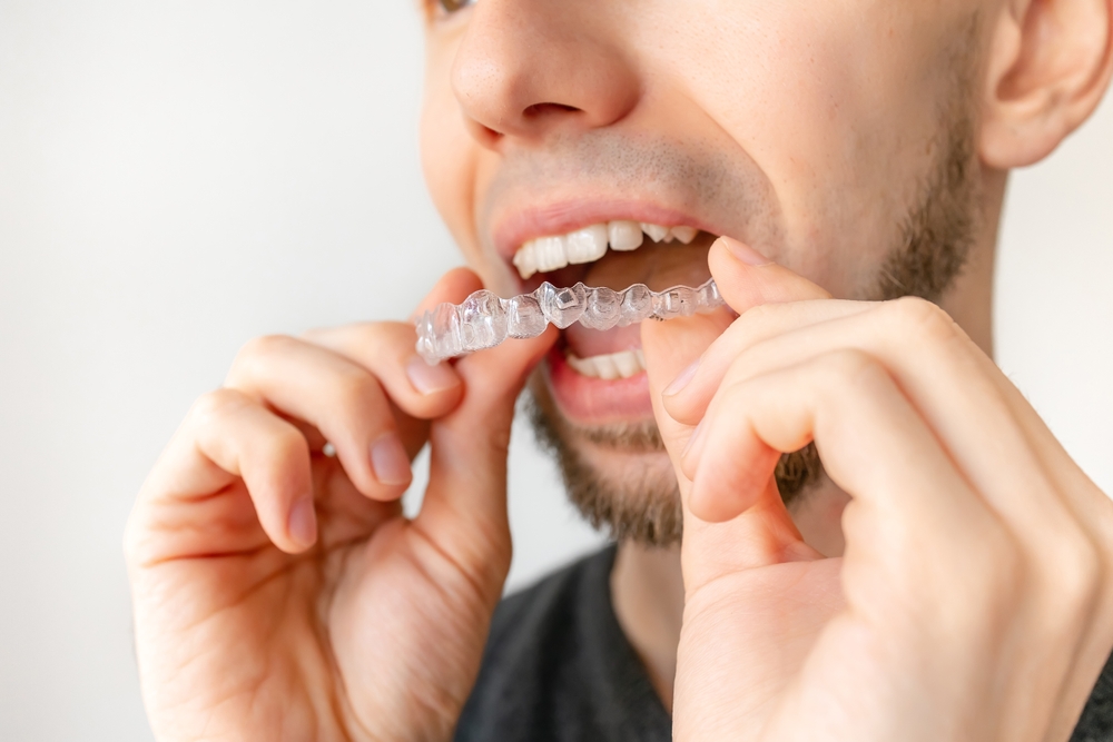 Invisalign Clear Aligners – Dentist Tacoma Close-up of man inserting Invisalign clear aligners – Dentist Tacoma