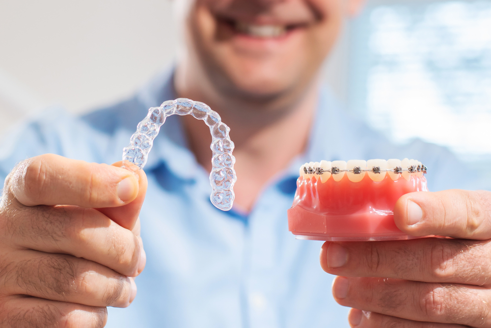 Man Holding Clear Aligner and Dental Model – Cosmetic Dentistry Smiling man presenting a clear aligner and a dental model with braces, highlighting options for smile enhancement – Cosmetic Dentistry